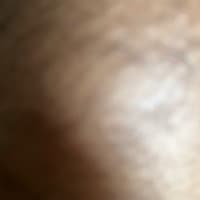 Anish
